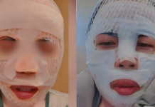 “变丑才不会被抢走!”恶男深夜泼滚烫热水毁容女友