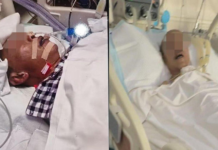 婚宴误将燃料当白酒 2男重中毒进ICU