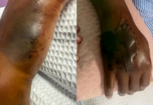 毒蛇藏鞋架突袭 男子误当猫抓险送命