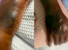 毒蛇藏鞋架突袭 男子误当猫抓险送命